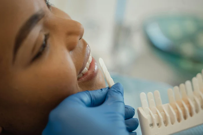 Sonrisa de paciente tras blanqueamientos de dientes con resultados visibles