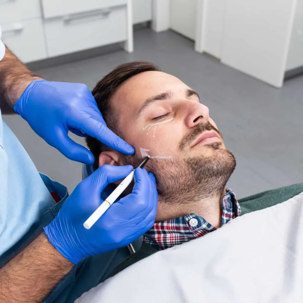 Antes y después de una bichectomía en hombres cachetones, donde el rostro luce más definido y con una mandíbula marcada tras el procedimiento.