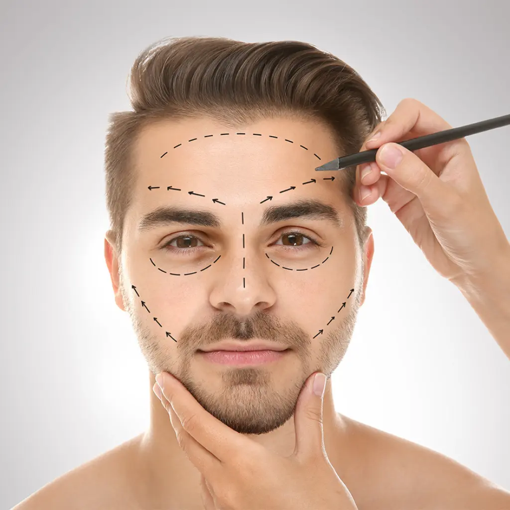 Análisis de la armonía del rostro masculino para planificar una bichectomía en hombres y definir los rasgos.
