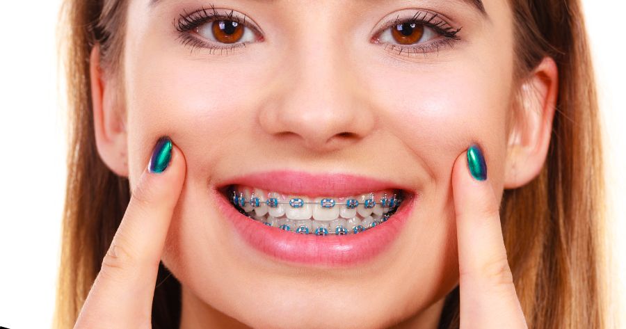 Consejos antes de comenzar tu tratamiento de ortodoncia