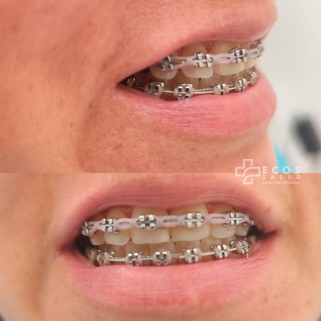 Atención de ortodoncia en ECOS Salud